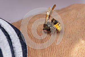 Hornet bites a manÃ¢â¬â¢s hand on a white background